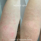 Blossom Balm · Multi-Use Healing Balm
